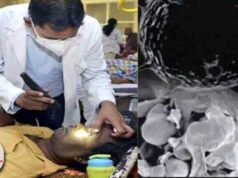 After black, now the risk of white fungus increases, know which states are in its havoc what-is-black-and-white-fungus-india-hindi-news